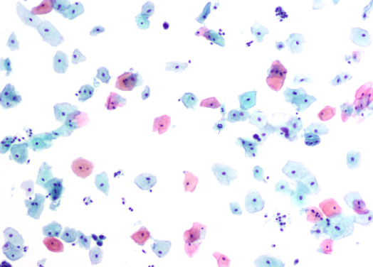 b779c003411eb4aa1222d092e5a46143.jpg
