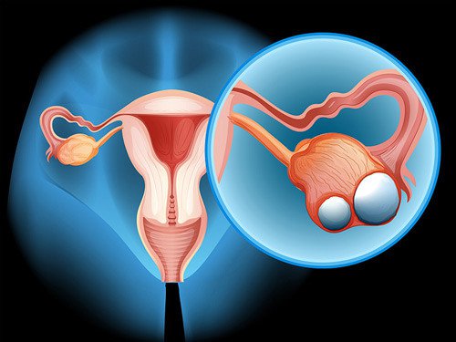 Gói tầm soát và phát hiện sớm ung thư phụ khoa 1