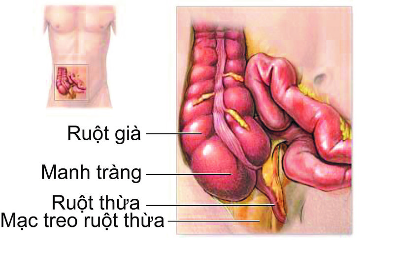 Ruột thừa là gì – Tìm hiểu cùng chuyên gia Vinmec