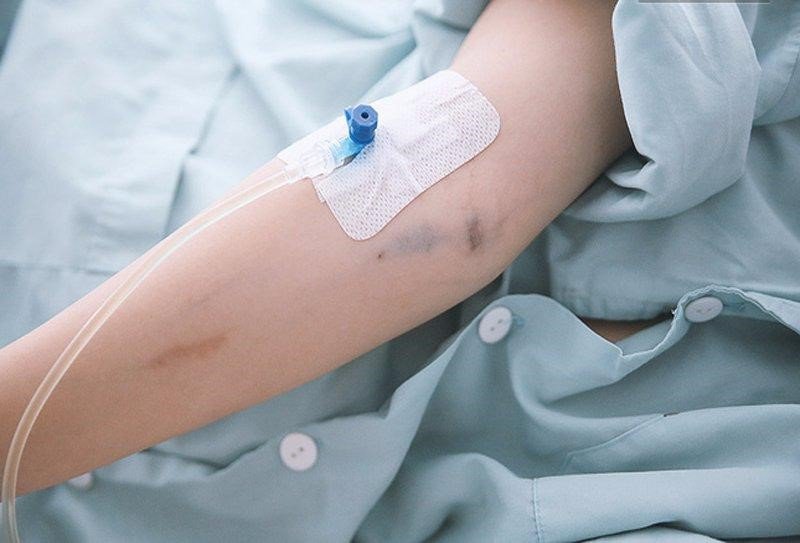 Tiêm tĩnh mạch: Chỉ định khi nào? Tiêm tĩnh mạch: Chỉ định khi nào?