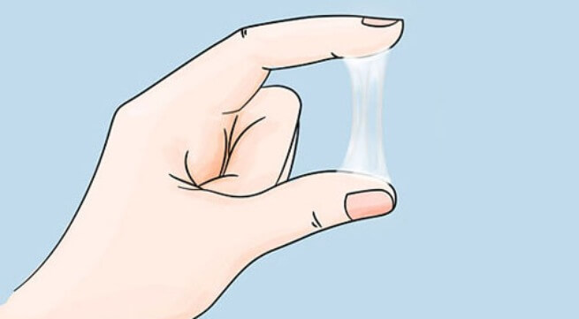 bệnh huyết trắng