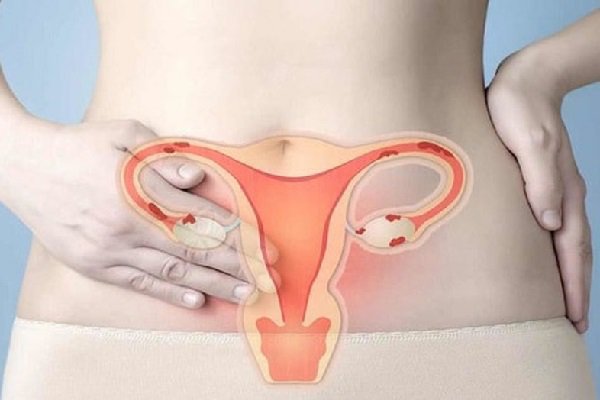 Hướng dẫn tầm soát ung thư cổ tử cung theo từng độ tuổi | Vinmec