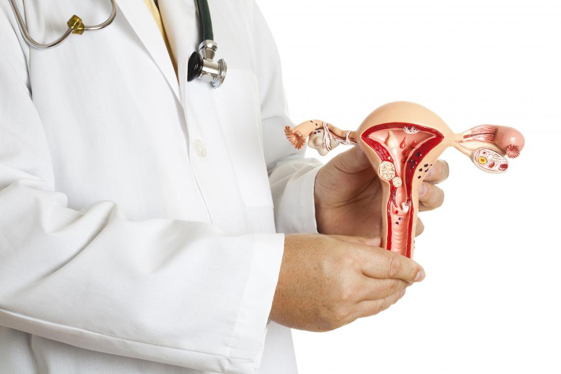 Is it possible to get pregnant after endometrial ablation? Vinmec