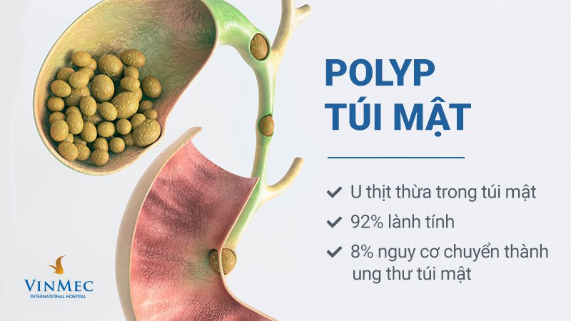 Polyp túi mật