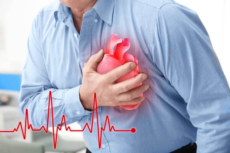 Chẩn đoán tim mạch - Gói chẩn đoán Ngất