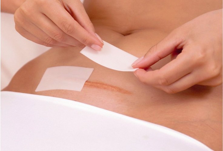 Chăm sóc sức khỏe thời kỳ hậu sản Chăm sóc sức khỏe thời kỳ hậu sản