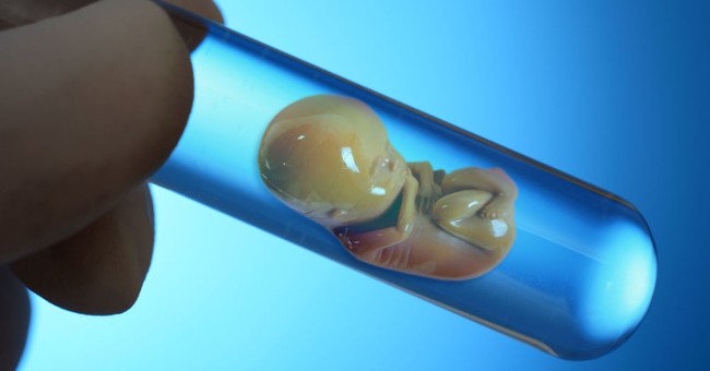 Biểu đồ xét nghiệm di truyền trước khi sinh