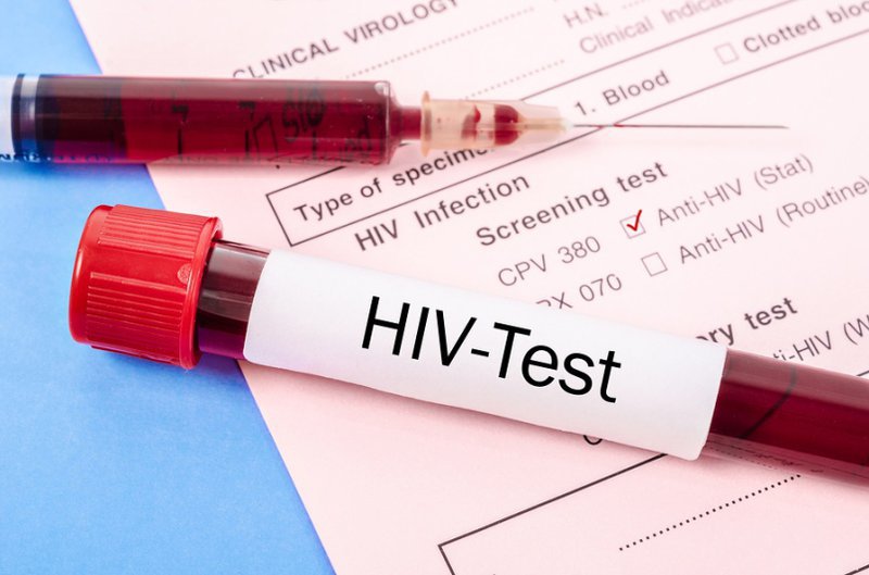 Thông tin và nguyên nhân 2 tháng xét nghiệm hiv có chính xác không mà bạn cần biết