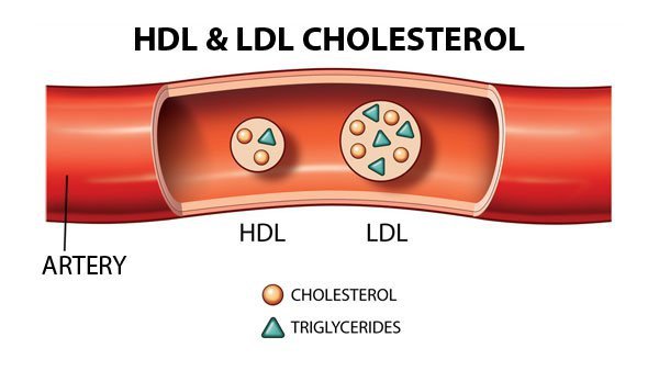 tai-sao-tang-cholesterol-trong-hoi-chung-than-hu-1