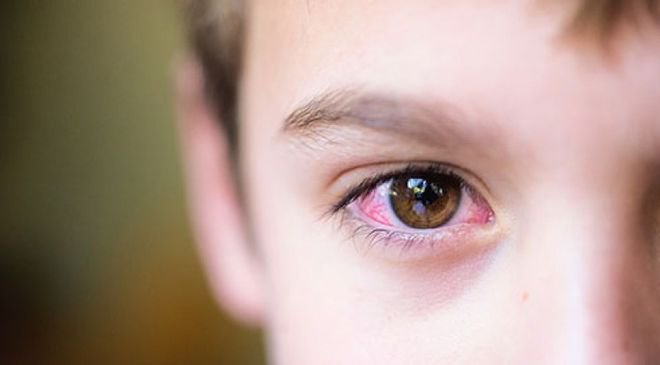 Mổ lasik chữa cận thị có an toàn không? Mổ lasik chữa cận thị có an toàn không?