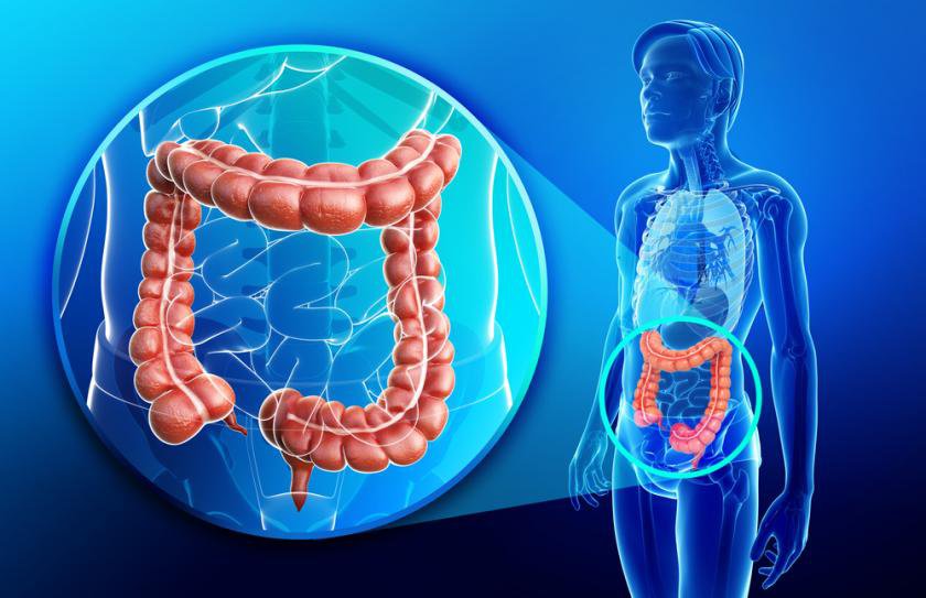 Viêm loét đại tràng ở trẻ em Viêm loét đại tràng ở trẻ em