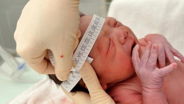 Giãn não thất có nguy hiểm không? Giãn não thất có nguy hiểm không?