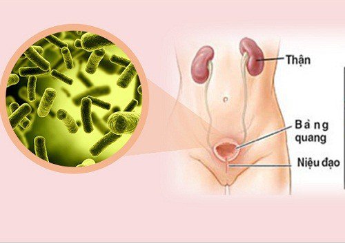 Thay đổi ở hệ tiết niệu khi mang thai Thay đổi ở hệ tiết niệu khi mang thai