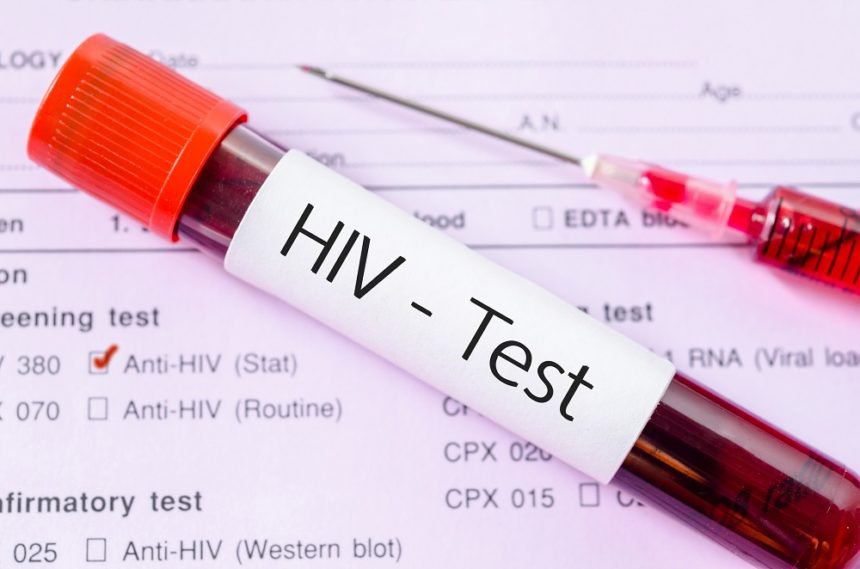 HIV test