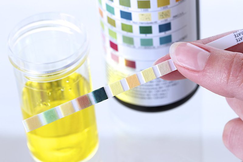 Chỉ số PH trong xét nghiệm nước tiểu