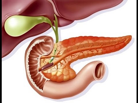 Biến chứng đặc biệt nguy hiểm của viêm tụy cấp