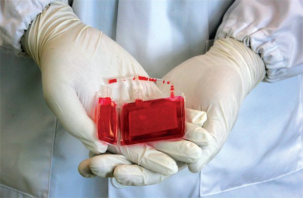 Chẩn đoán và điều trị rubella bẩm sinh Chẩn đoán và điều trị rubella bẩm sinh