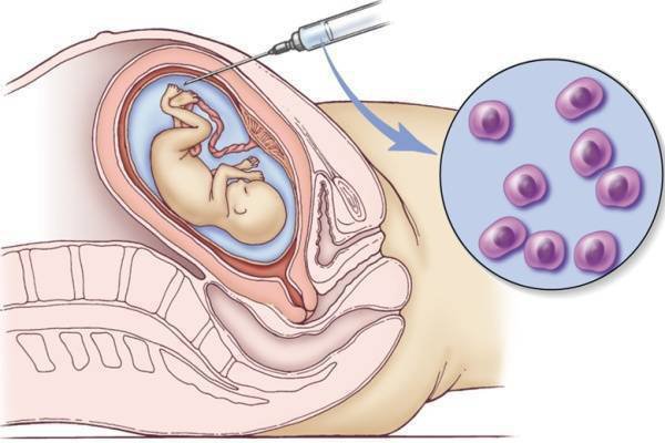Sự thay đổi của bà bầu tuần 15 Sự thay đổi của bà bầu tuần 15