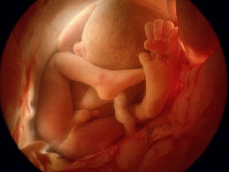 Siêu âm 4D thời điểm nào tốt nhất? Siêu âm 4D thời điểm nào tốt nhất?