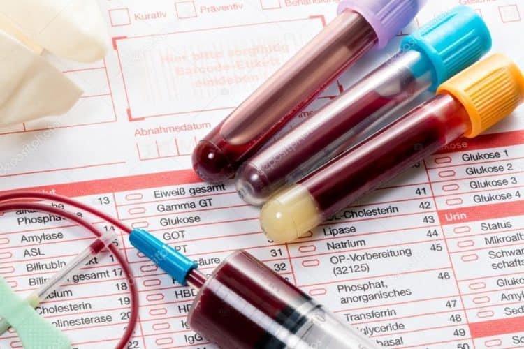 Tìm hiểu về EV71 - Tác nhân gây viêm não, tay chân miệng Tìm hiểu về EV71 - Tác nhân gây viêm não, tay chân miệng