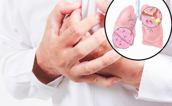 Biến chứng của viêm phế quản cấp Biến chứng của viêm phế quản cấp