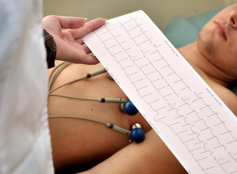 Tiêu chuẩn chẩn đoán tăng áp động mạch phổi Tiêu chuẩn chẩn đoán tăng áp động mạch phổi