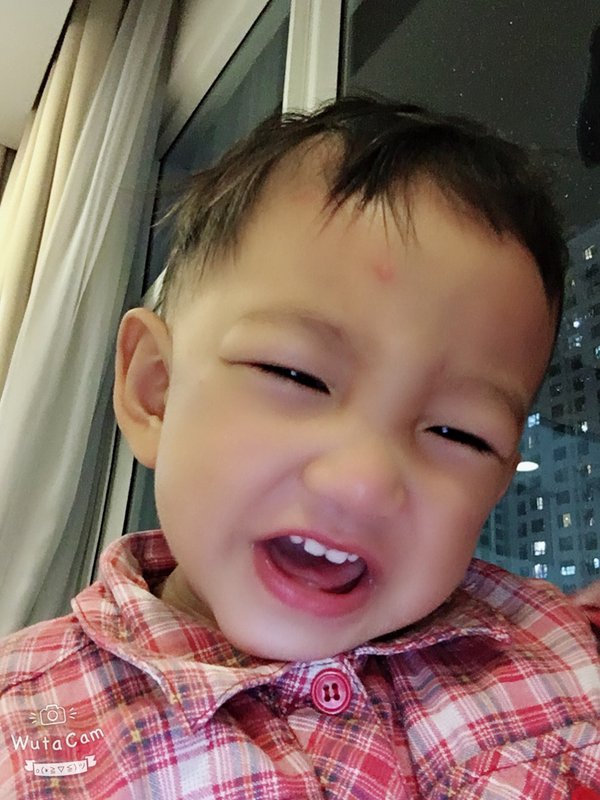 Ung thư võng mạc