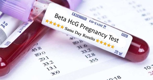 Xét nghiệm máu có biết mình mang thai không Xét nghiệm máu có biết mình mang thai không