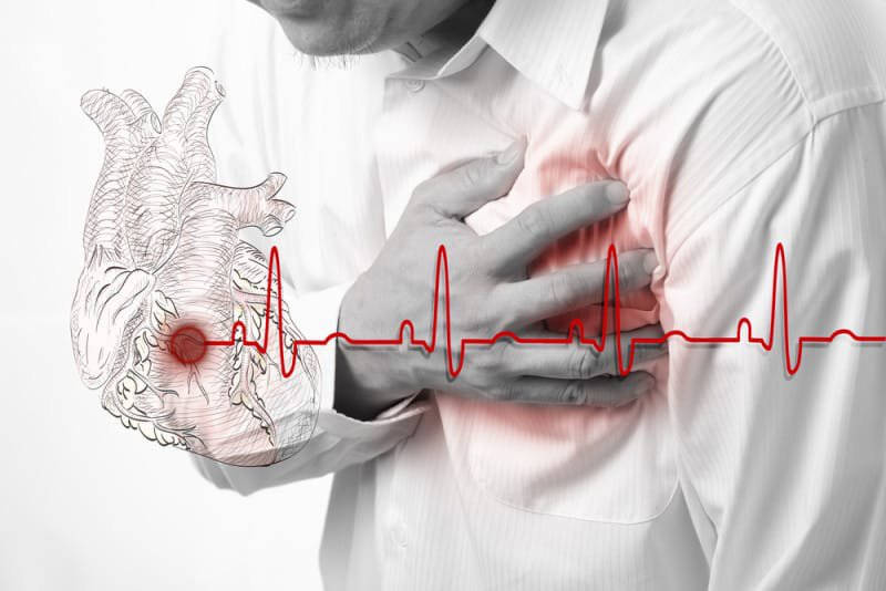 Biến chứng nguy hiểm của xơ vữa động mạch vành Biến chứng nguy hiểm của xơ vữa động mạch vành