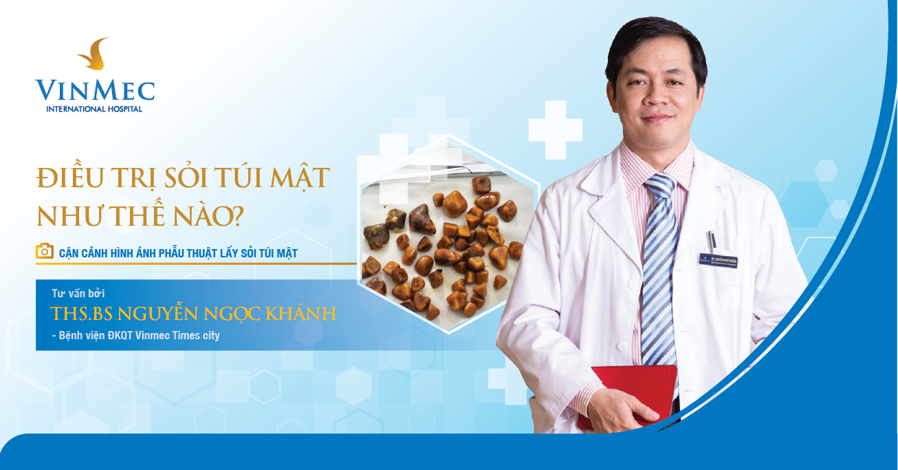 Sỏi túi mật và cách xử trí Vinmec