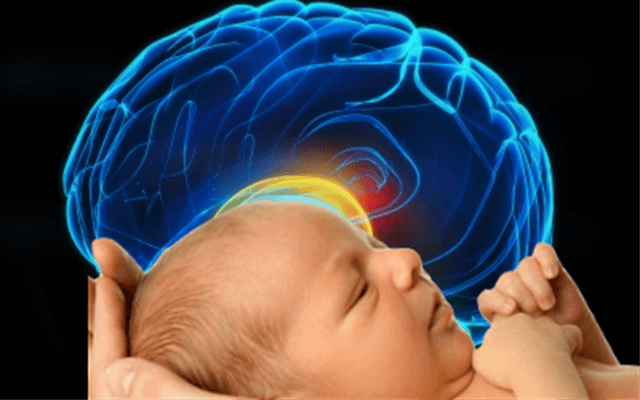 Ngạt khi sinh: Những biến chứng nguy hiểm Ngạt khi sinh: Những biến chứng nguy hiểm