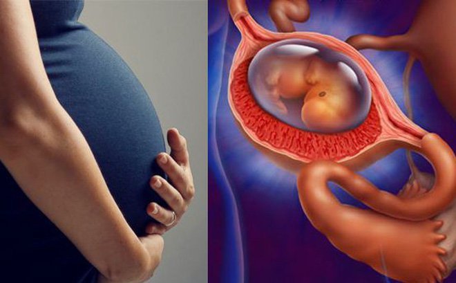 Bảo tồn vòi tử cung ở người bị thai ngoài tử cung Bảo tồn vòi tử cung ở người bị thai ngoài tử cung