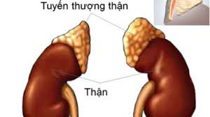 U tuỷ thượng thận