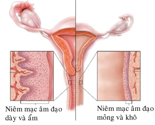 Điều trị teo âm đạo