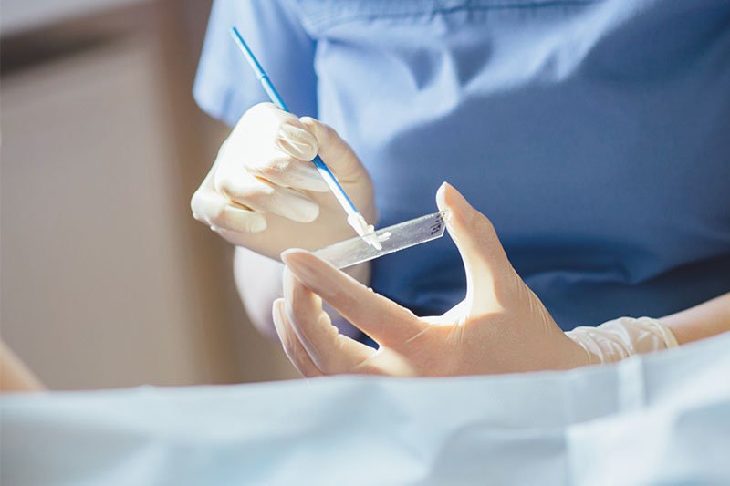 Chẩn đoán và điều trị viêm cổ tử cung Chẩn đoán và điều trị viêm cổ tử cung