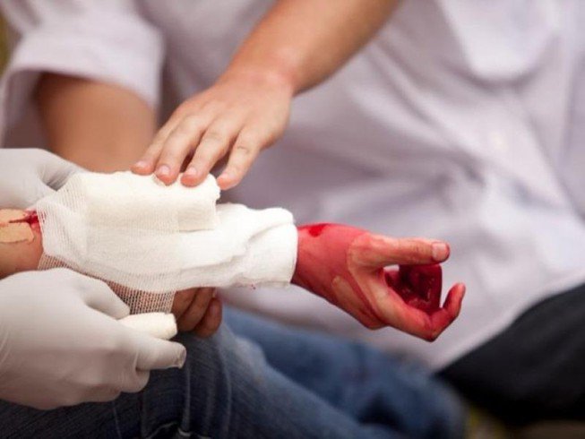 Sơ cứu vết thương mạch máu Sơ cứu vết thương mạch máu