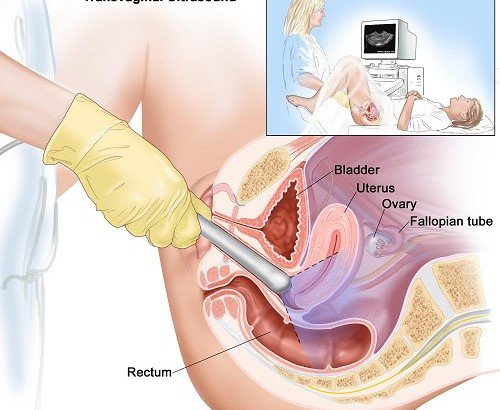 Khi nào bạn cần gặp bác sĩ hiếm muộn? Khi nào bạn cần gặp bác sĩ hiếm muộn?