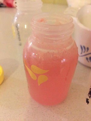 Nhiễm vi khuẩn Serratia marcescens ở bà mẹ mới sinh Nhiễm vi khuẩn Serratia marcescens ở bà mẹ mới sinh