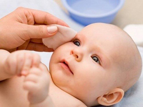 Cách xử trí chảy nước mắt sống do tắc lệ đạo ở trẻ Cách xử trí chảy nước mắt sống do tắc lệ đạo ở trẻ