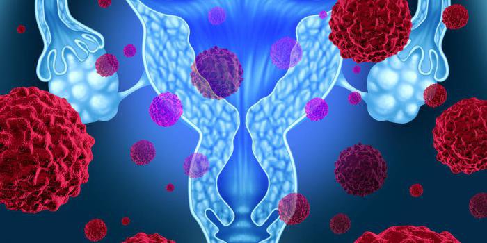 Vì sao virus HPV 16 và 18 là nguyên nhân hàng đầu gây ung thư cổ tử cung? Vì sao virus HPV 16 và 18 là nguyên nhân hàng đầu gây ung thư cổ tử cung?