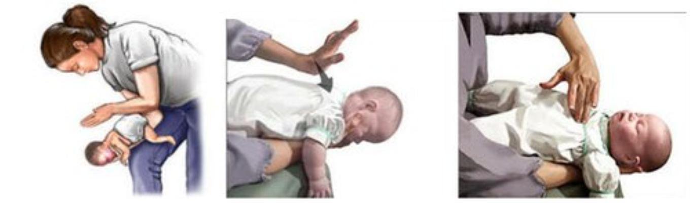 Cấp cứu sặc sữa