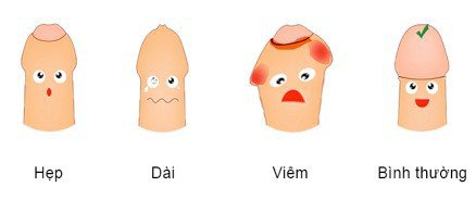 Cách chăm sóc dương vật chưa cắt bao quy đầu của trẻ Cách chăm sóc dương vật chưa cắt bao quy đầu của trẻ