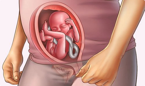 Tìm hiểu hội chứng giảm sản tim trái Tìm hiểu hội chứng giảm sản tim trái