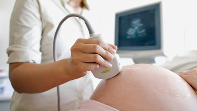 Giãn bể lớn hố sau ở thai nhi Giãn bể lớn hố sau ở thai nhi