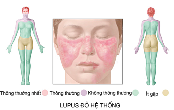 16 điều có thể gây ra đau đầu và mệt mỏi 16 điều có thể gây ra đau đầu và mệt mỏi