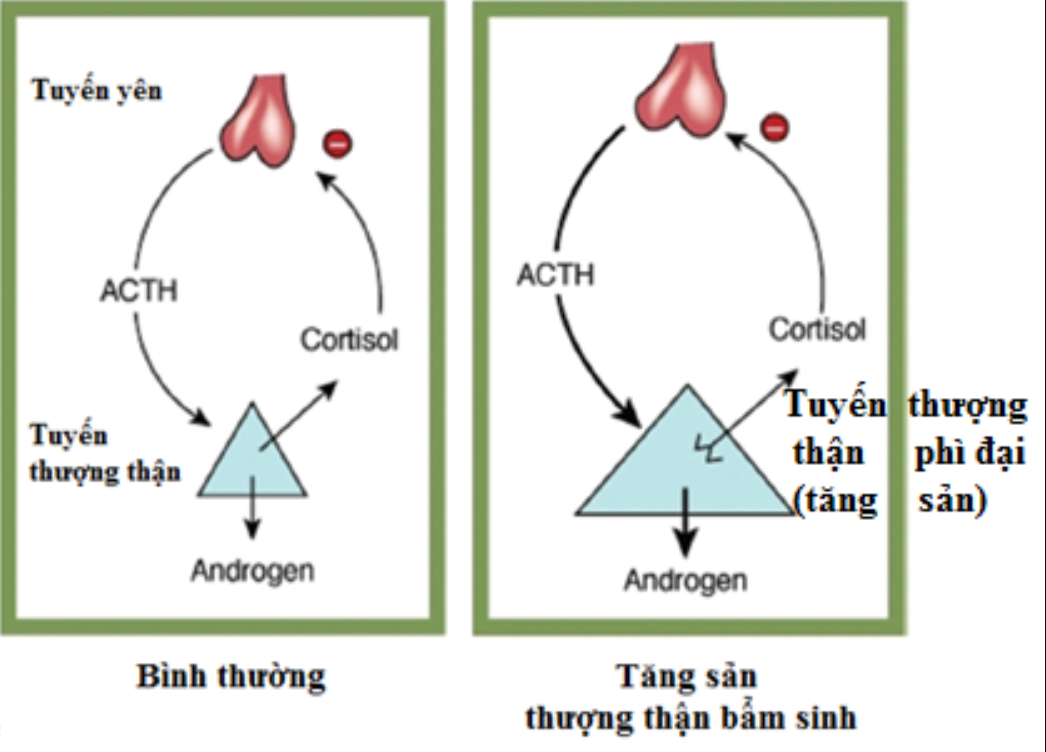Sàng lọc sơ sinh tại Vinmec Phú Quốc Sàng lọc sơ sinh tại Vinmec Phú Quốc