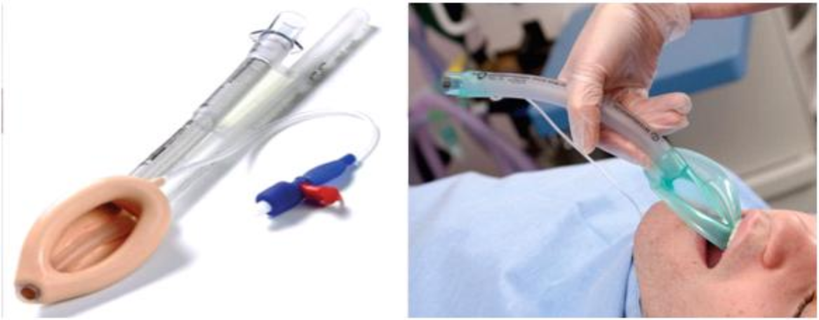Đặt mặt nạ thanh quản trong cấp cứu đường thở Đặt mặt nạ thanh quản trong cấp cứu đường thở