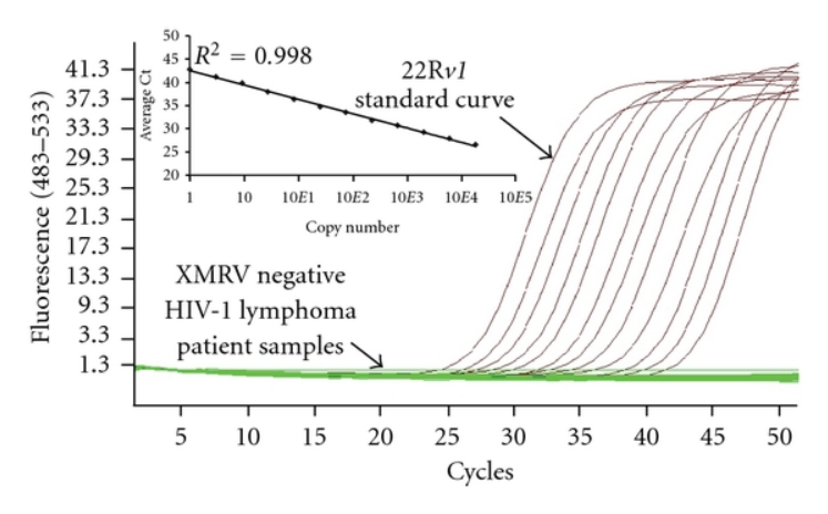 Xét nghiệm HIV sau 8 tuần có chính xác không? Xét nghiệm HIV sau 8 tuần có chính xác không?