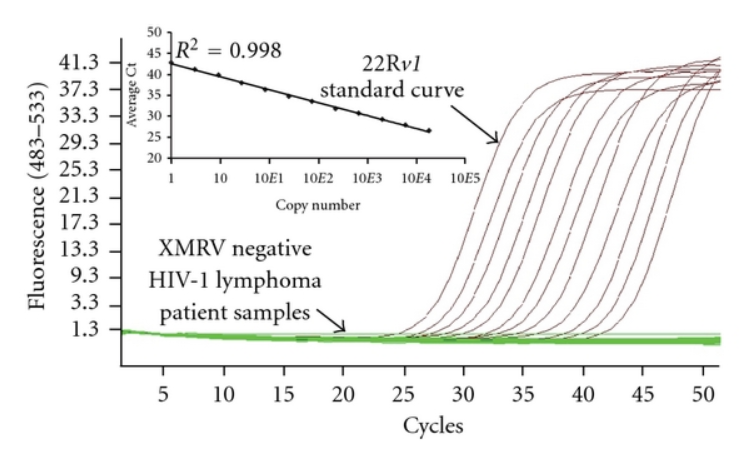 xét nghiệm PCR