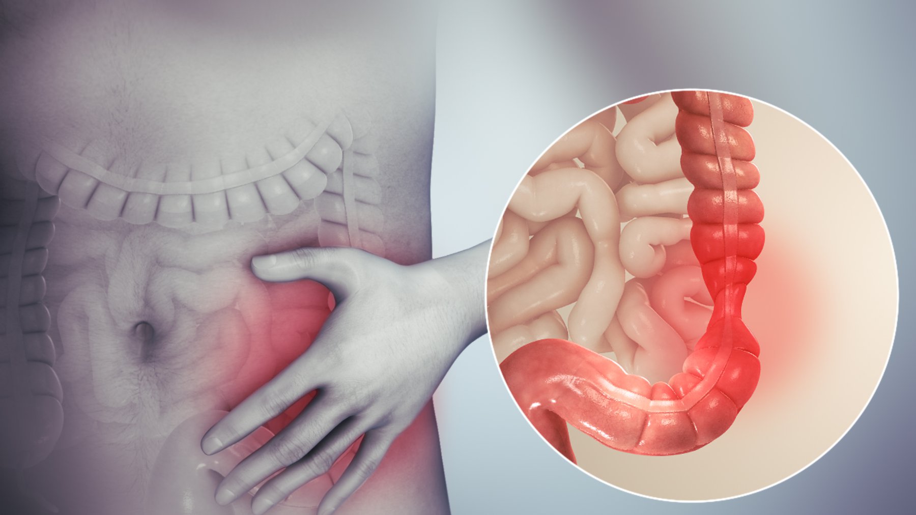 Thắt ống dẫn trứng là gì? Thắt ống dẫn trứng là gì?